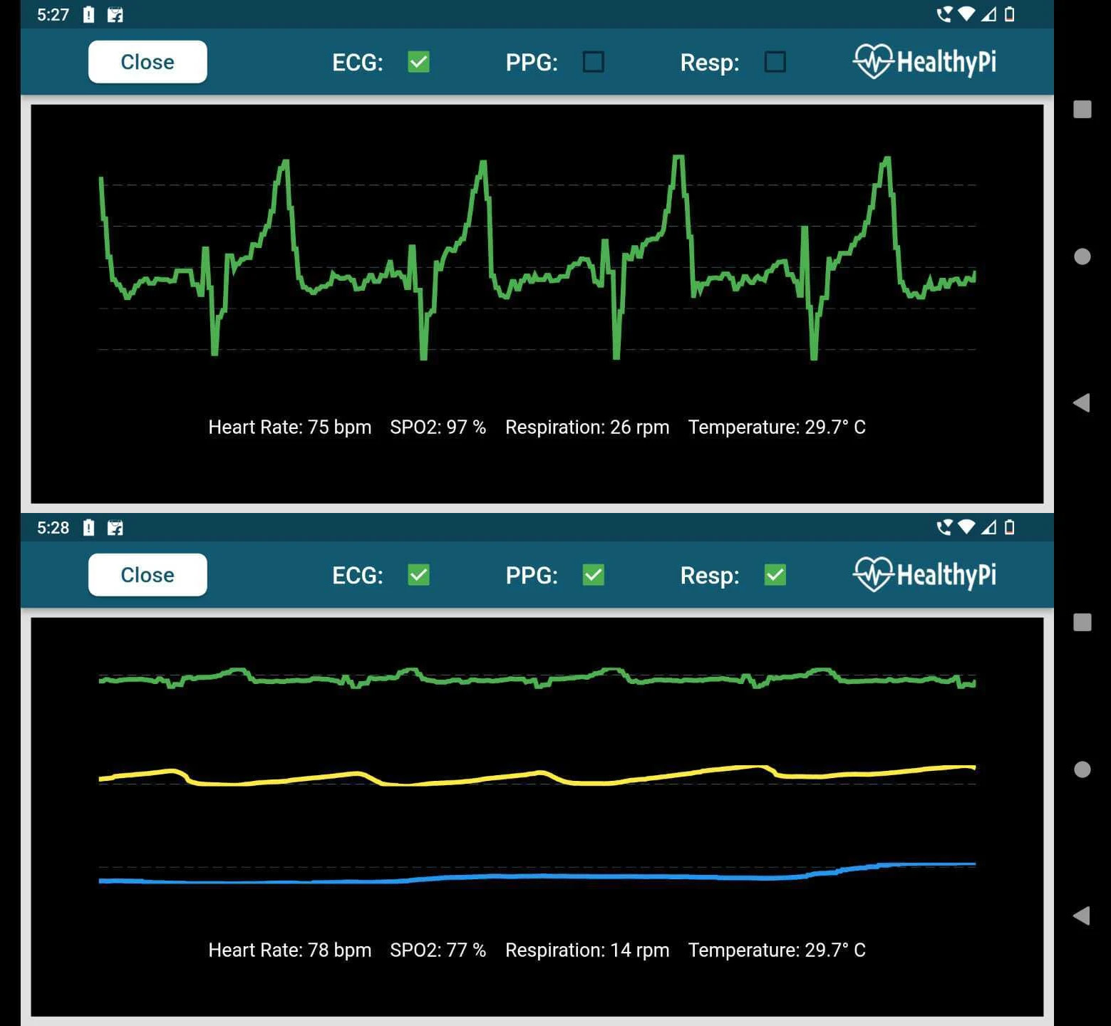 HealthyPi Android App
